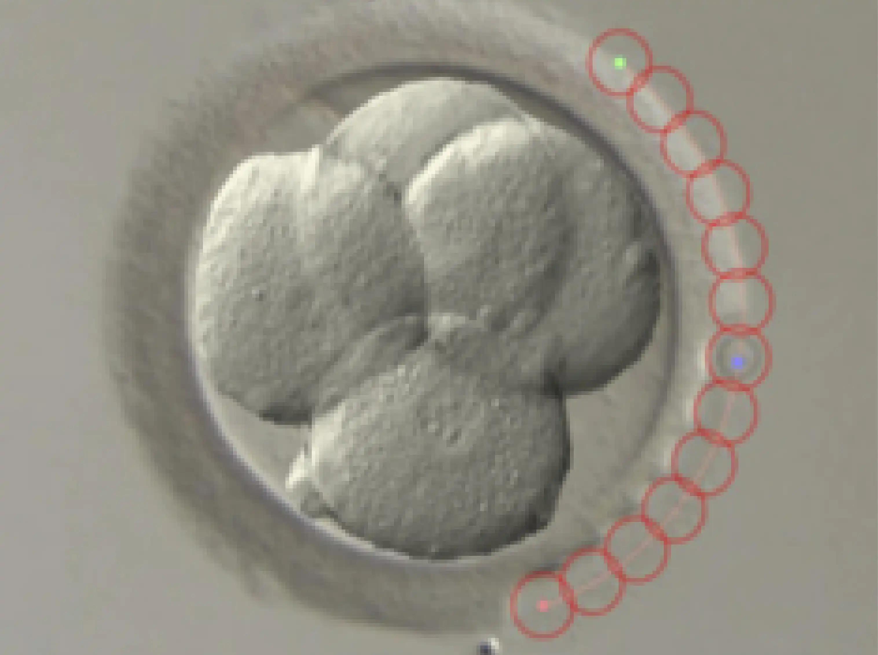 In Vitro Fertilization (IVF) | KSA
